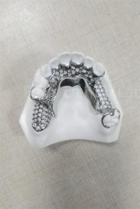 High Stability Flexible Partial Dentures Easy Cleaning Regular Maintenance