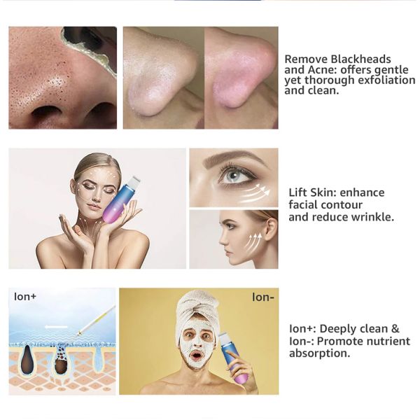 Ultrasonic Ion Therapy Vibrating Facial Scrubber Skin Clean Peeling Warm Scraper
