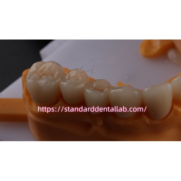 Layered Dental Zirconia Crown And Bridge Translucency 3D PRO Zirconia Porcelain Crown Standard Dental Lab