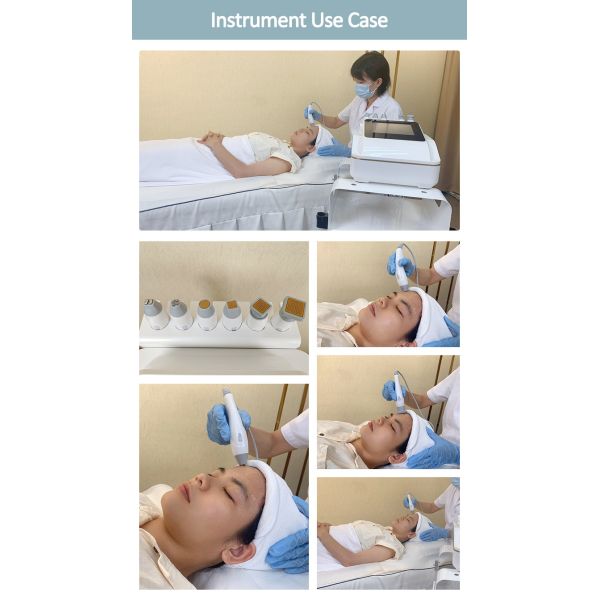 Electric Microcurrent Multipolar RF Therapy Anti Aging Face Wrinkle Removal Machine