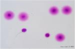 Economical Sperm DNA Fragmentation Test Kit For DNA Fragmentation Level