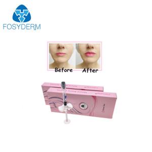 China Lip Nose Chin Fullness Crosslinked HA Hyaluronic Acid Injectable Filler 24mg / Ml on sale