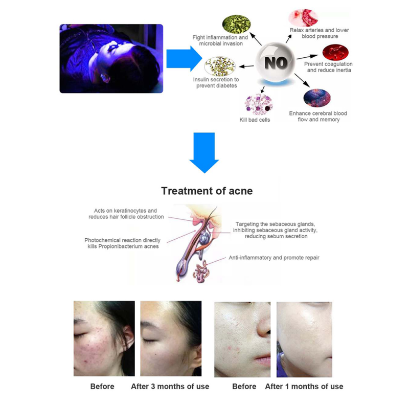 PBM Red LED Light Therapy Bed Photodynamic Machine For Fatigue Treatment